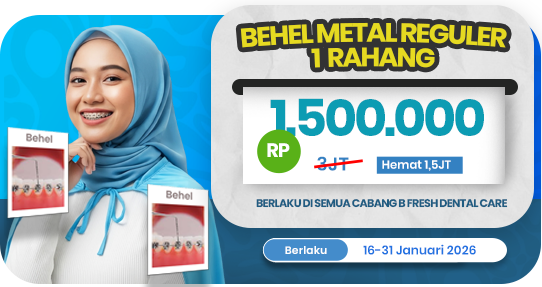 Behel Metal Reguler 1 rahang