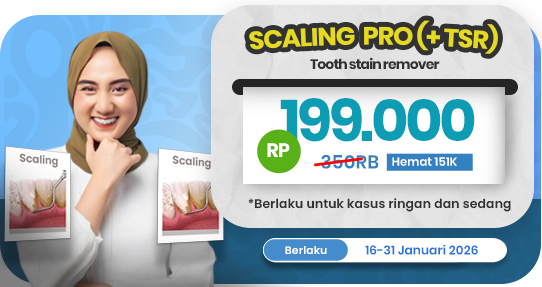 Scaling gigi PRO (+TSR)