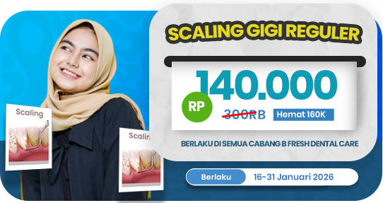 Scaling Gigi Reguler
