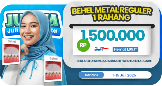 Behel Metal Reguler 1 rahang