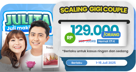 Scaling Gigi Couple