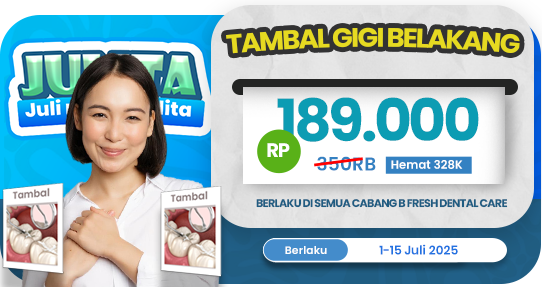 Tambal gigi Belakang