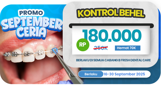 Kontrol Behel Gigi