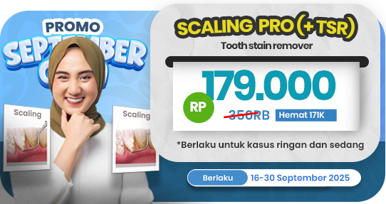 Scaling gigi PRO (+TSR)