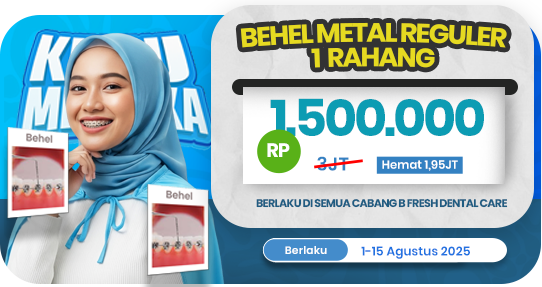 Behel Metal Reguler 1 rahang